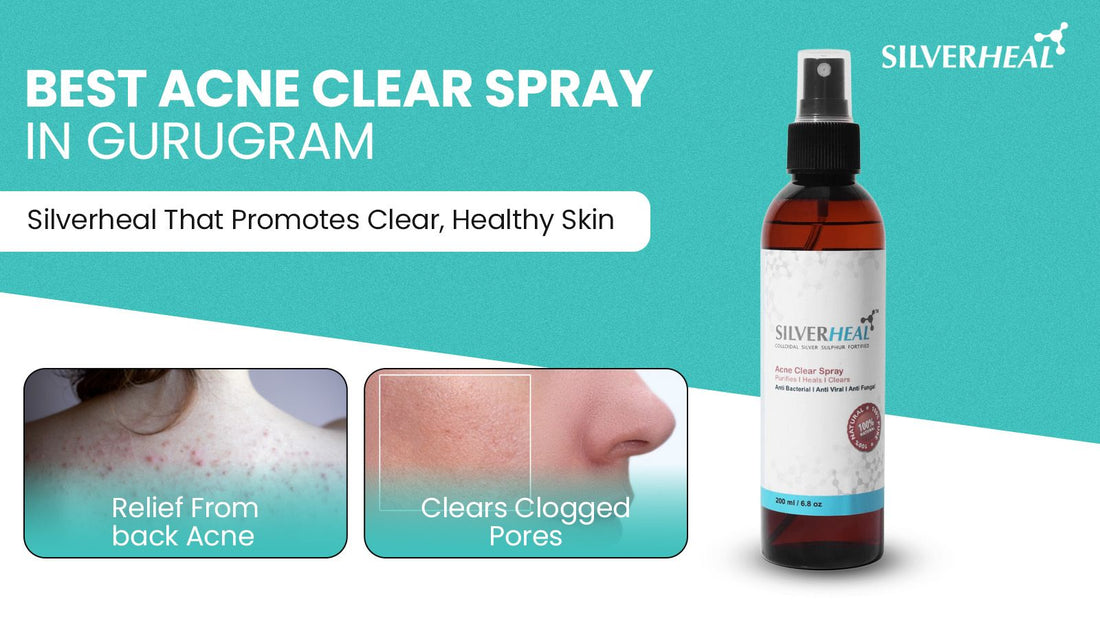 Best Acne Clear Spray in Gurugram – SILVERHEAL That Promotes Clear, Healthy Skin