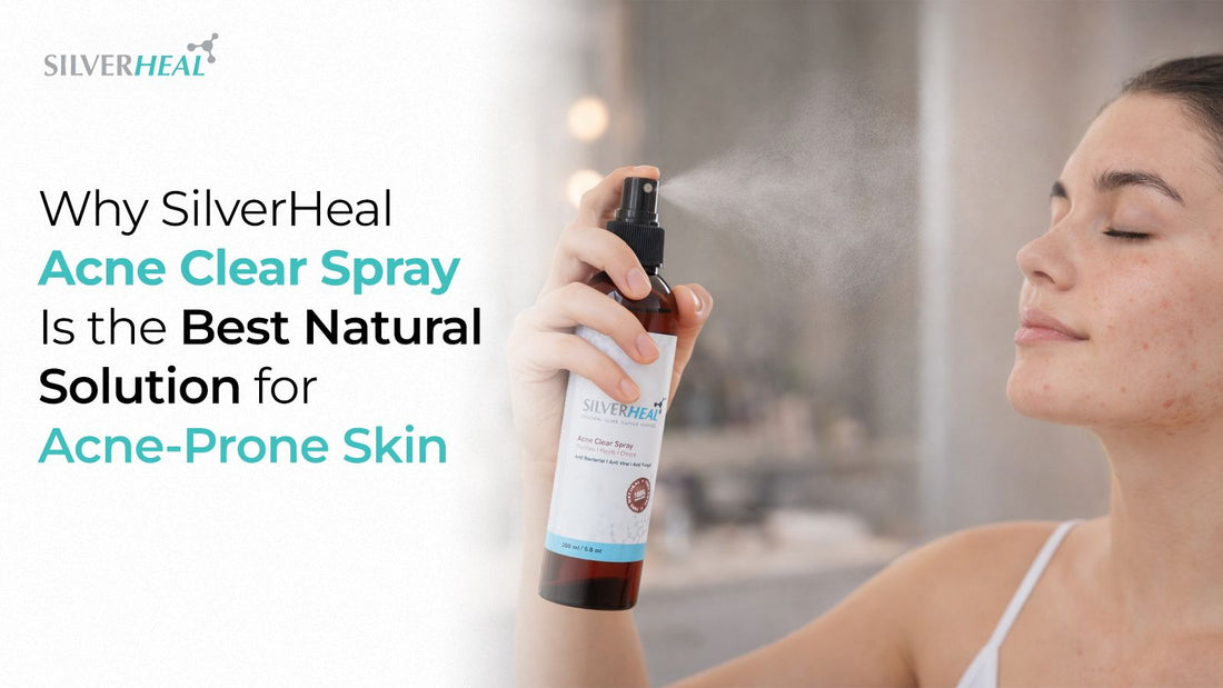 Why SilverHeal Acne Clear Spray Is the Best Natural Solution for Acne-Prone Skin