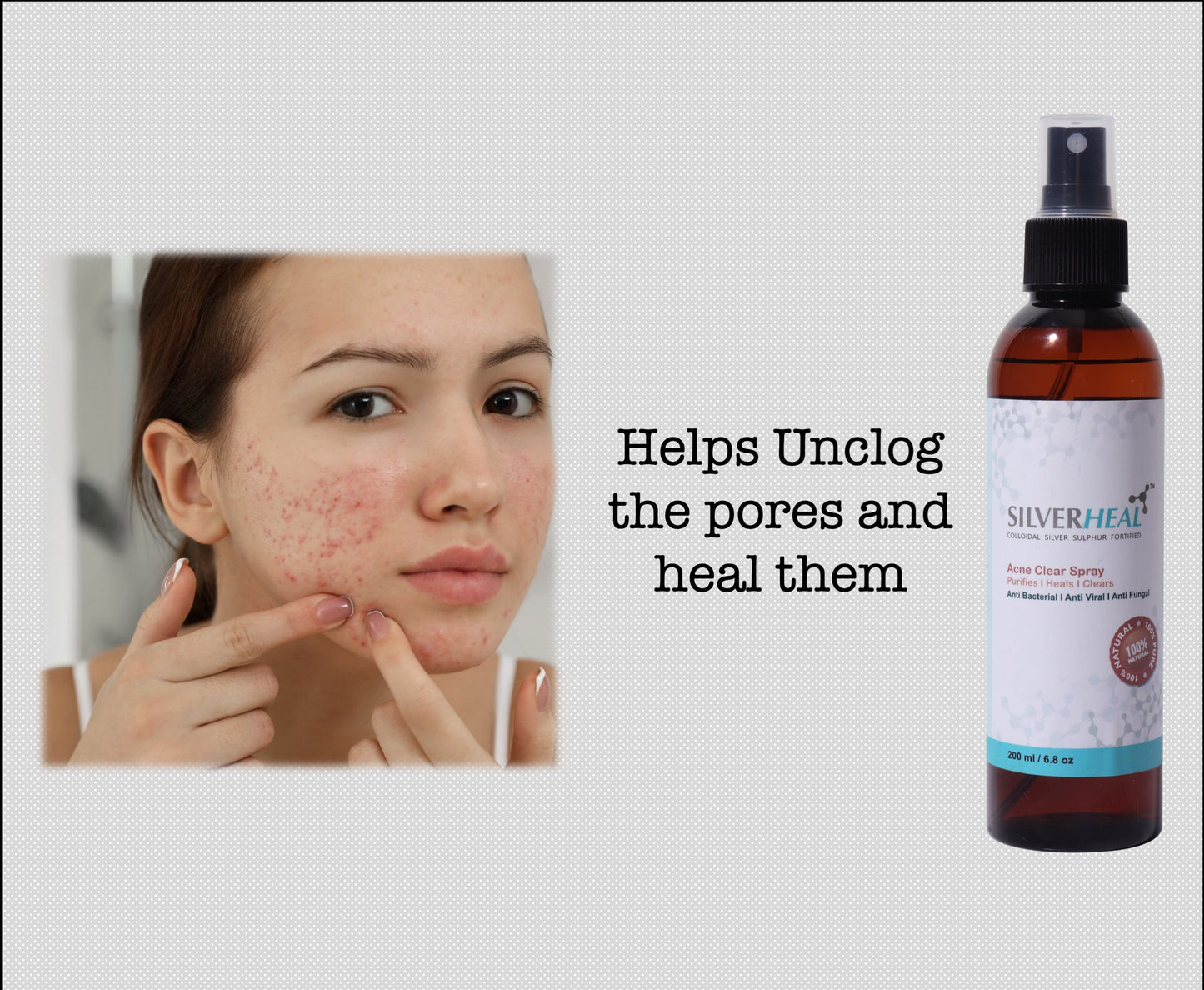 Acne Clear Spray